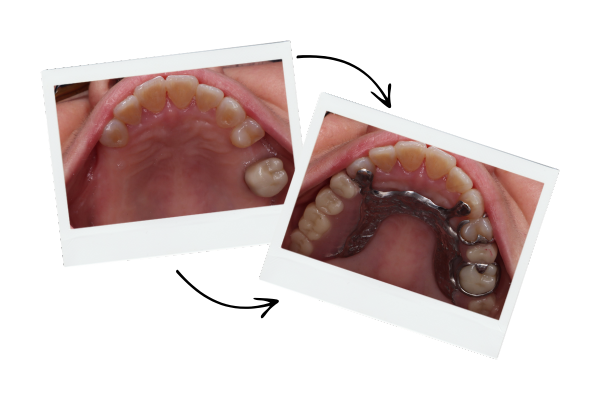 Rehabilitación Oral