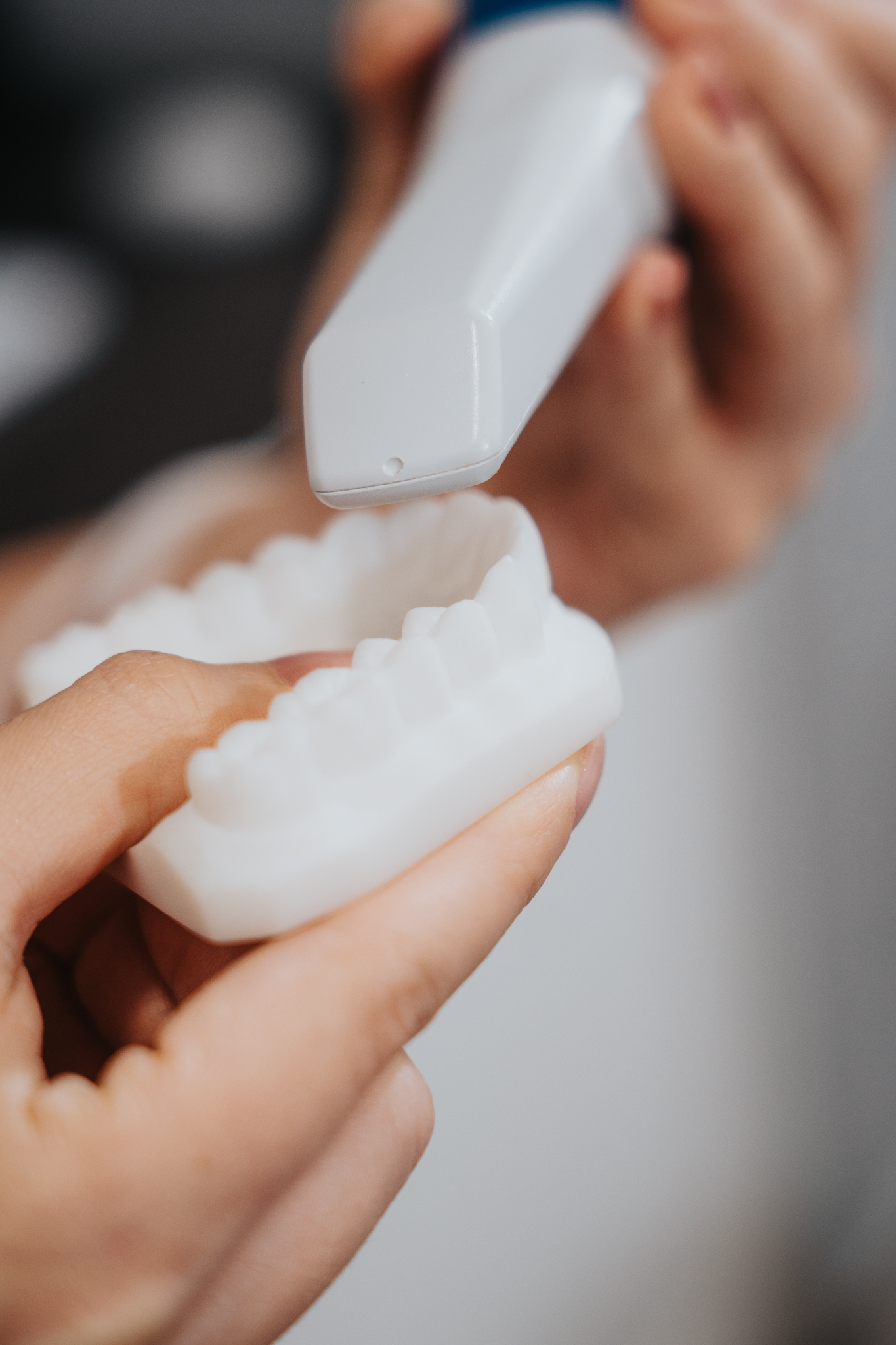 Blanqueamiento dental